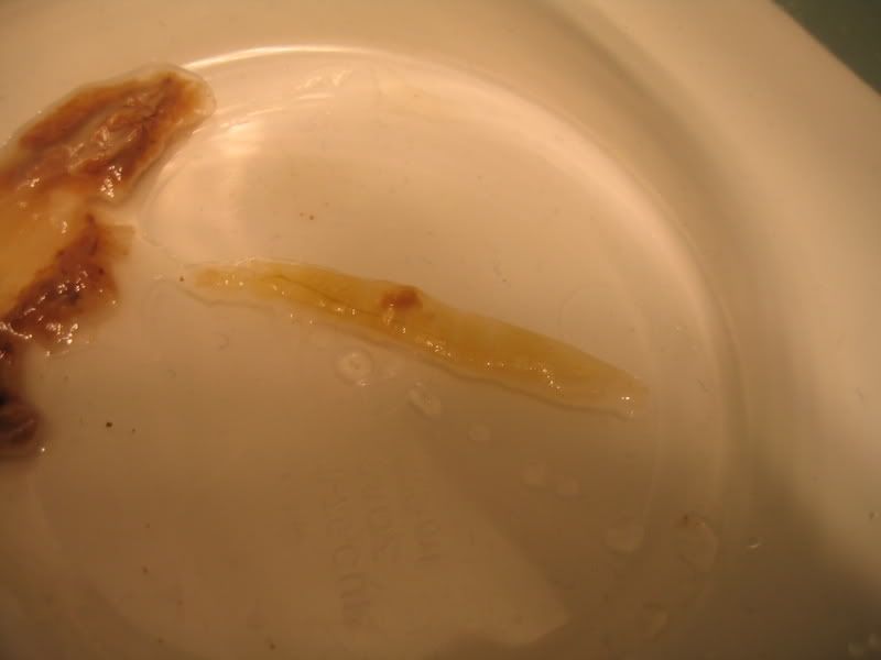 One of many worms from Lugol's/kefir enemas